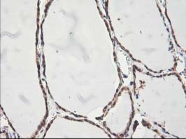 IHC of paraffin-embedded Human thyroid tissue using anti-NIF3L1 mouse monoclonal antibody.