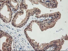 IHC of paraffin-embedded Human prostate tissue using anti-NIF3L1 mouse monoclonal antibody.