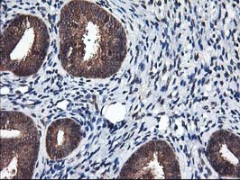 IHC of paraffin-embedded Human endometrium tissue using anti-NIF3L1 mouse monoclonal antibody.
