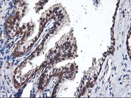 IHC of paraffin-embedded Human prostate tissue using anti-NIF3L1 mouse monoclonal antibody.