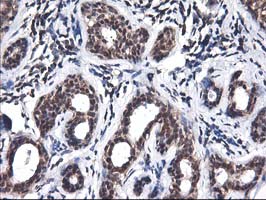 IHC of paraffin-embedded Human breast tissue using anti-NIF3L1 mouse monoclonal antibody.