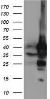 HEK293T cells were transfected with the pCMV6-ENTRY control (Left lane) or pCMV6-ENTRY NIF3L1 (Right lane) cDNA for 48 hrs and lysed. Equivalent amounts of cell lysates (5 ug per lane) were separated by SDS-PAGE and immunoblotted with anti-NIF3L1.