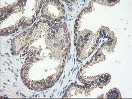 IHC of paraffin-embedded Human prostate tissue using anti-NIF3L1 mouse monoclonal antibody. (Heat-induced epitope retrieval by 10mM citric buffer, pH6.0, 100C for 10min).