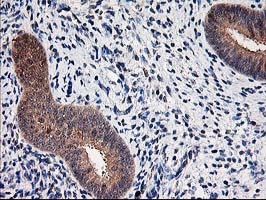 IHC of paraffin-embedded Human endometrium tissue using anti-NIF3L1 mouse monoclonal antibody. (Heat-induced epitope retrieval by 10mM citric buffer, pH6.0, 100C for 10min).