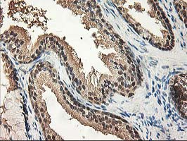IHC of paraffin-embedded Human prostate tissue using anti-NIF3L1 mouse monoclonal antibody.