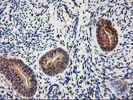 IHC of paraffin-embedded Human endometrium tissue using anti-NIF3L1 mouse monoclonal antibody.