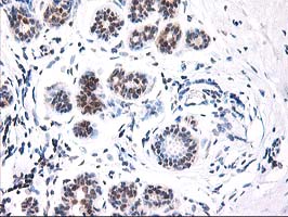 IHC of paraffin-embedded Human breast tissue using anti-NIF3L1 mouse monoclonal antibody.