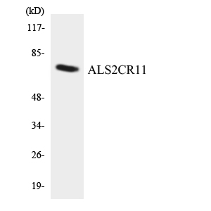 Western blot of the lysates from COLO205 cells using ALS2CR11 antibody.