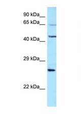 ALS2CR11 antibody LS-C146036 Western blot of 721_B Cell lysate. Antibody concentration 1 ug/ml.