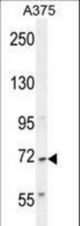 AL2SA Antibody western blot of A375 cell line lysates (35 ug/lane). The AL2SA antibody detected the AL2SA protein (arrow).