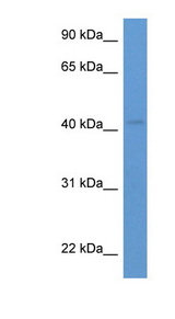 HSH2D antibody LS-C135857 Western blot of Fetal Kidney lysate.