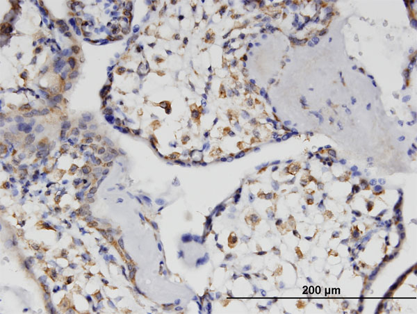 Immunoperoxidase of monoclonal antibody to HSH2D on formalin-fixed paraffin-embedded human placenta. [antibody concentration 3 ug/ml]