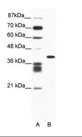A: Marker, B: Jurkat Cell Lysate