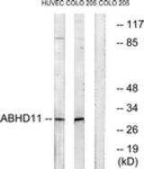 Western blot of extracts from COLO/HUVEC cells, using ABHD11 Antibody. The lane on the right is treated with the synthesized peptide.