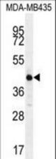 ALX4 Antibody western blot of MDA-MB435 cell line lysates (35 ug/lane). The ALX4 antibody detected the ALX4 protein (arrow).