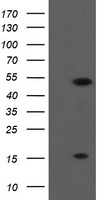 HEK293T cells were transfected with the pCMV6-ENTRY control (Left lane) or pCMV6-ENTRY ALX4 (Right lane) cDNA for 48 hrs and lysed. Equivalent amounts of cell lysates (5 ug per lane) were separated by SDS-PAGE and immunoblotted with anti-ALX4.