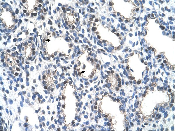 THOC4 antibody LS-C31923 was used in IHC to stain formalin-fixed, paraffin-embedded human lung.