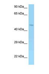 AMACR antibody LS-C146292 Western blot of 721_B Cell lysate. Antibody concentration 1 ug/ml.
