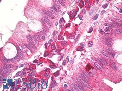 Anti-AMBRA1 antibody IHC of human small intestine. Immunohistochemistry of formalin-fixed, paraffin-embedded tissue after heat-induced antigen retrieval. Antibody LS-B7940 dilution 10 ug/ml.