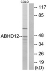 Western blot of extracts from COLO cells, using ABHD12 Antibody. The lane on the right is treated with the synthesized peptide.