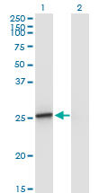 Western Blot analysis of AMELX expression in transfected 293T cell line by AMELX monoclonal antibody (M02A), clone 5B2.Lane 1: AMELX transfected lysate (Predicted MW: 21.6 KDa).Lane 2: Non-transfected lysate.