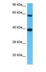 Western blot of AMHR2 Antibody with human 721_B Whole Cell lysate.