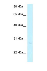 ABHD12B antibody LS-C145927 Western blot of Jurkat Cell lysate. Antibody concentration 1 ug/ml.