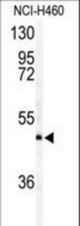 Western blot of AIFM2 antibody in NCI-H460 cell line lysates (35 ug/lane). AIFM2 (arrow) was detected using the purified antibody.