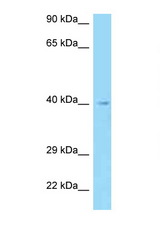 AADACL3 antibody LS-C145375 Western blot of HepG2 Cell lysate. Antibody concentration 1 ug/ml.
