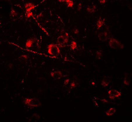 Immunofluorescence of AMIGO1 in human brain tissue with AMIGO1 antibody at 20 µg/mL.
