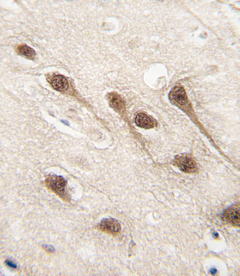 Formalin-fixed and paraffin-embedded human brain tissue reacted with RUNX1 Antibody (S276) , which was peroxidase-conjugated to the secondary antibody, followed by DAB staining. This data demonstrates the use of this antibody for immunohistochemistry; clinical relevance has not been evaluated.