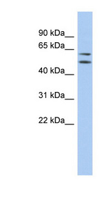 ABHD15 antibody LS-C111514 Western blot of 721_B cell lysate.