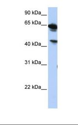 HepG2 cell lysate. Antibody concentration: 1.0 ug/ml. Gel concentration: 12%.