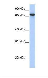 HepG2 cell lysate. Antibody concentration: 1.0 ug/ml. Gel concentration: 12%.