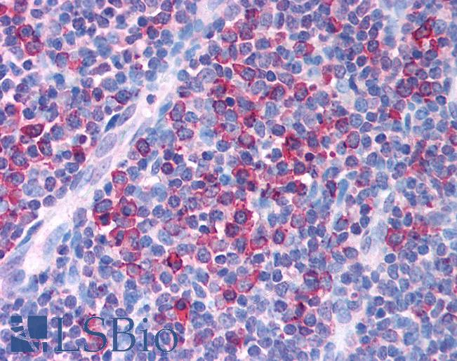 Anti-RUNX1 antibody IHC of human tonsil. Immunohistochemistry of formalin-fixed, paraffin-embedded tissue after heat-induced antigen retrieval. Antibody LS-B998 concentration 5 ug/ml.