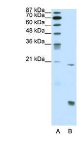 RUNX1 antibody LS-B998 Western blot of Jurkat lysate.