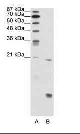 A: Marker, B: Jurkat Cell Lysate