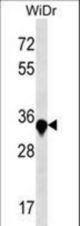 AMMECR1 Antibody western blot of WiDr cell line lysates (35 ug/lane). The AMMECR1 antibody detected the AMMECR1 protein (arrow).