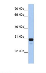 Fetal lung lysate. Antibody concentration: 1.0 ug/ml. Gel concentration: 12%.