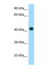 AADACL3 antibody LS-C146165 Western blot of HeLa Cell lysate. Antibody concentration 1 ug/ml.