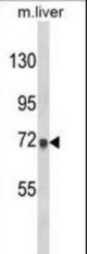 Western blot of AMOTL2 Antibody in mouse liver tissue lysates (35 ug/lane). AMOTL2 (arrow) was detected using the purified antibody.