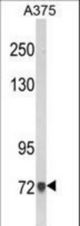 Western blot of AMOTL2 Antibody in A375 cell line lysates (35 ug/lane). AMOTL2 (arrow) was detected using the purified antibody.