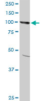 AMPD2 monoclonal antibody (M09), clone 6A8. Western blot of AMPD2 expression in HeLa.