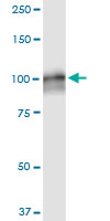 AMPD2 monoclonal antibody (M09), clone 6A8. Western blot of AMPD2 expression in human kidney.