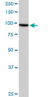 AMPD2 monoclonal antibody (M09), clone 6A8. Western blot of AMPD2 expression in human liver.