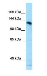 AMPD2 antibody Western Blot of MCF7.