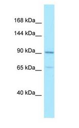 AMPD2 antibody Western Blot of HeLa.