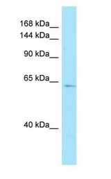 AMPD3 antibody Western Blot of Placenta.