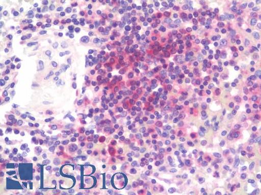 Human Spleen: Formalin-Fixed, Paraffin-Embedded (FFPE)