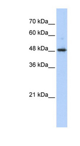 ABHD2 antibody LS-C101669 Western blot of Transfected 293T cell lysate.